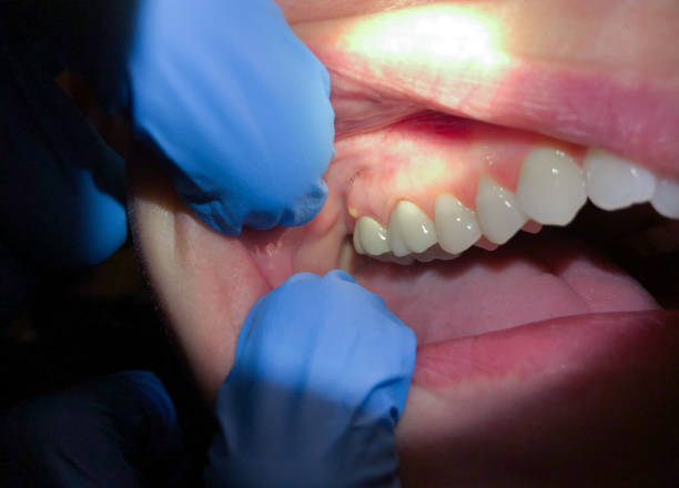 Best Emergency Denture Repair in Marriott Slaterville, UT